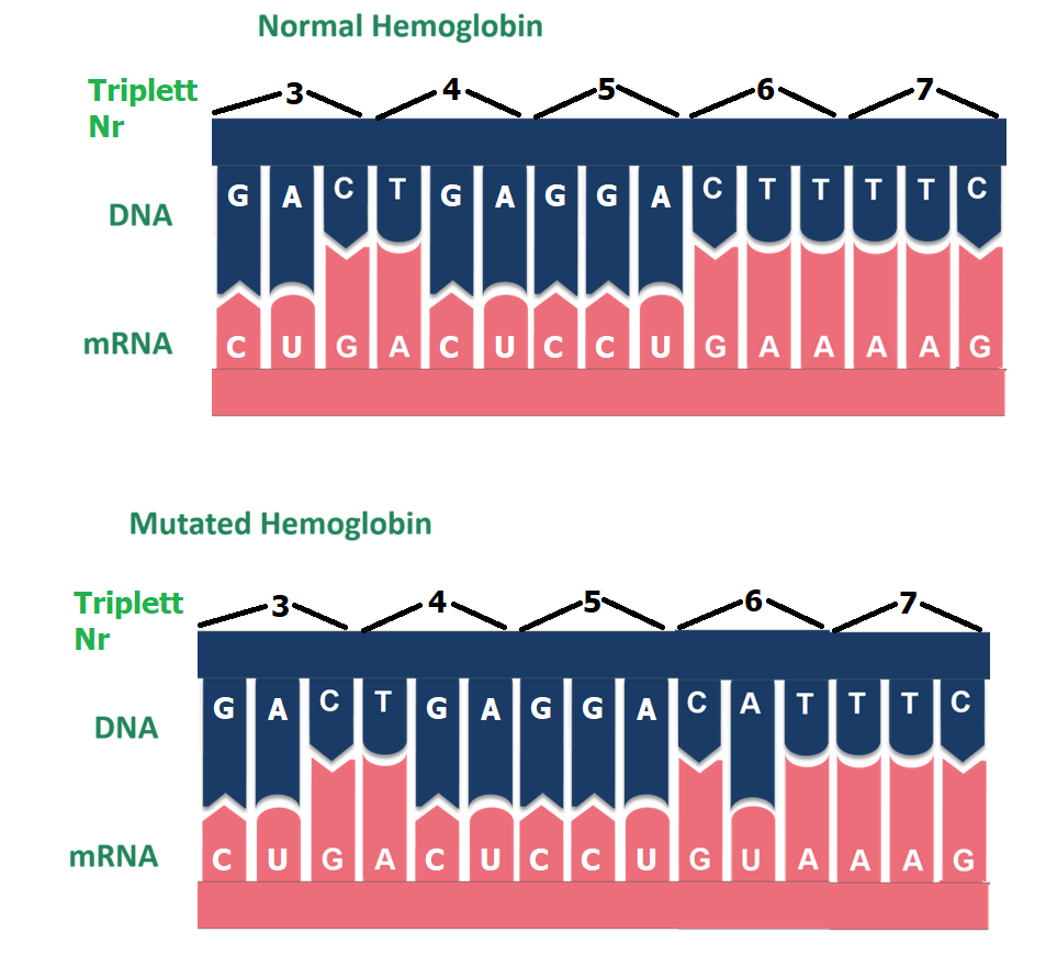 Abb.5: Ausschnitt aus dem Gen der beta-Untereinheit und die dazugehörige mRNA des normalen und des bei der Sichelzellanämie mutieren Gens